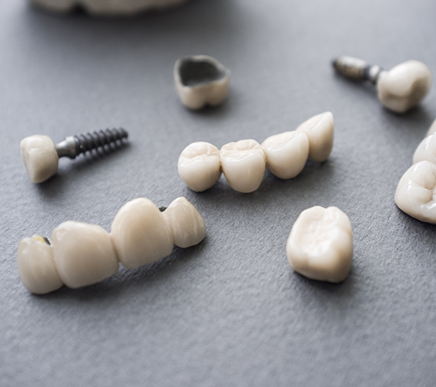 Rock Hill The Difference Between Dental Implants and Mini Dental Implants