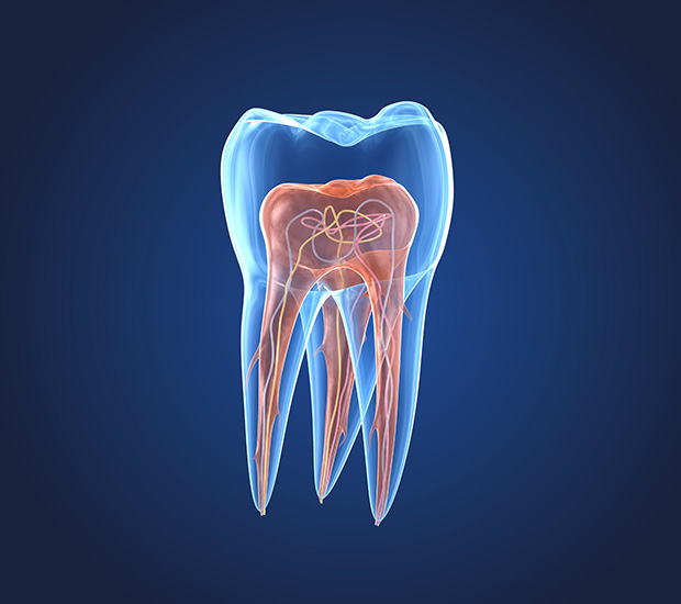 Rock Hill What is an Endodontist